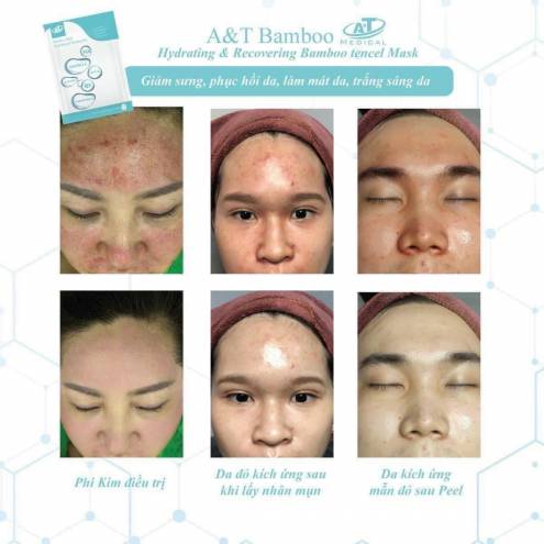 Mặt Nạ A&T Bamboo Mask Hydrating & Recovery B5 