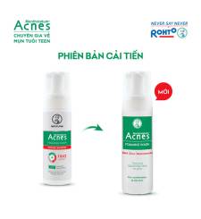 Dung Dịch Rửa Mặt Tạo Bọt Acnes Foaming Wash Hỗ Trợ Giảm Mụn, Hạn Chế Sẹo Thâm (Chai 150ml)