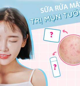 Top 5 sữa rửa mặt cho da dầu mụn tuổi dậy thì