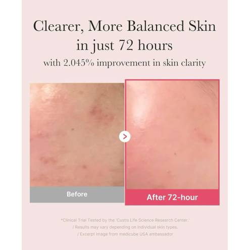 Tinh Chất Hỗ Trợ Dưỡng Sáng, Mờ Thâm Medicube TXA Niacinamide 15% Serum - 30ml