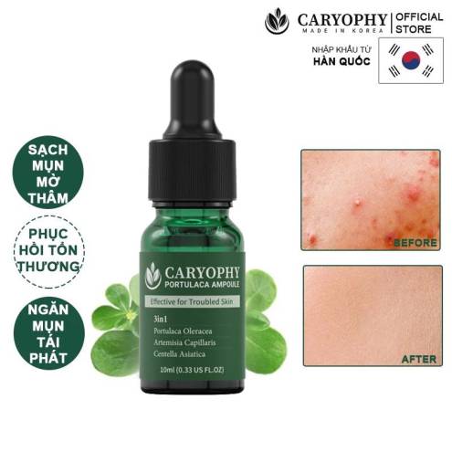 Tinh Chất Trị Mụn Trị Thâm Mụn Caryophy Portulaca Ampoule 