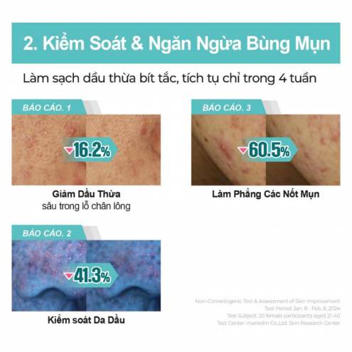 Kem Dưỡng Numbuzin No1 Pantothenic B5 Active Smoothing 80ml