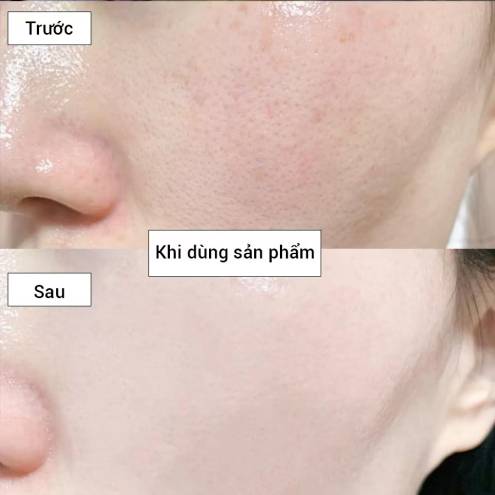 SERUM PURE RETINOL NHẬT BẢN 60ML