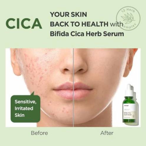 Tinh Chất Dưỡng Da Thảo Dược Manyo Bifida Cica Herb Serum 50ml