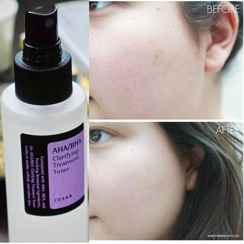 Nước Hoa Hồng Trị Mụn Cosrx AHA/BHA Clarifying Treatment Toner