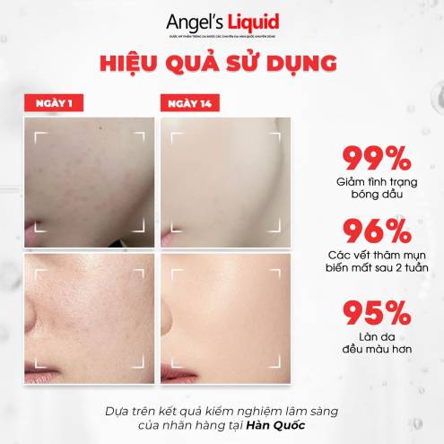 Serum dưỡng da Angel Liquid Glutathione Niacinamide Cica Ampoule 45ml
