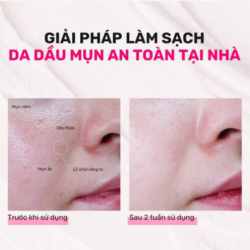 Derladie Mặt Nạ Đất Sét Thuần Chay 60g