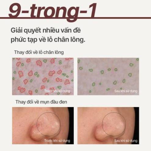 Mặt Nạ Tro Núi Lửa Trị Mụn Đầu Đen, Chăm Sóc Lỗ Chân Lông Innisfree Super Volcanic Pore Clay Mask 2X 100ml