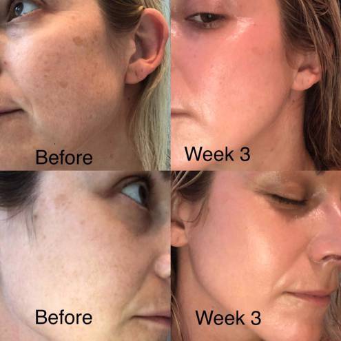 Serum phục hồi da Zo Skin Health Growth Factor Serum 30ML