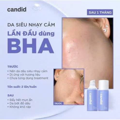 Gel tẩy tế bào chết BHA Candid 100ml