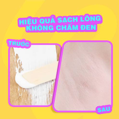 Kem tẩy lông Cleo