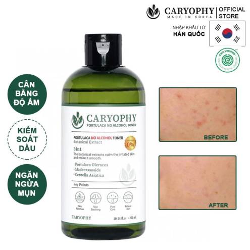 Nước Hoa Hồng Trị Mụn Caryophy Portulaca Toner