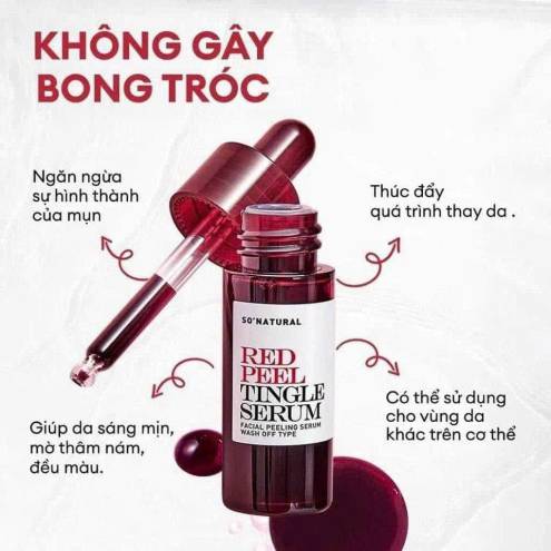 Tinh chất peel da SONATURAL Red Peel Tingle 