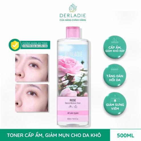 Nước Hoa Hồng Kháng Viêm, Ngăn Ngừa Mụn, Thu Nhỏ Lỗ Chân Lông Chiết Xuất Hoa Hồng Derladie Natural Moisture Toner - Rose 500ml