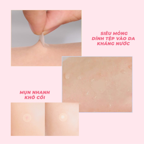 Miếng Dán Mụn Dr.G A'Clear Ultra Thin Spot Patch 30 Miếng