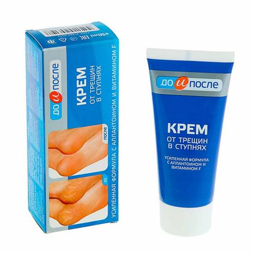 Kem Trị Nứt Gót Chân Kpem Apteka  