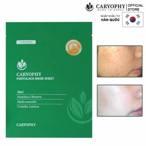 Mặt Nạ Miếng Làm Dịu, Phục Hồi Dành Cho Da Dầu Mụn Caryophy Portulaca Mask Sheet