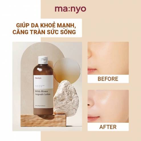 Nước Hoa Hồng Manyo Bifida Biome Ampoule Toner 400ml 