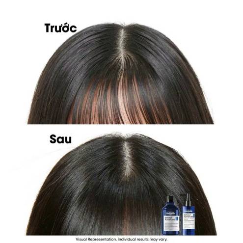 Tinh chất mọc tóc dày hơn L'Oréal Serioxyl Denser Hair - 90ml  (kèm gội cho tóc nhuộm 100ml)