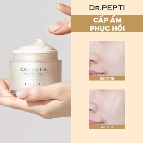 Kem Dưỡng Ẩm Chiết Xuất Từ Rau Má Dr.Pepti+ Centella Moist Soothing Gel Cream 