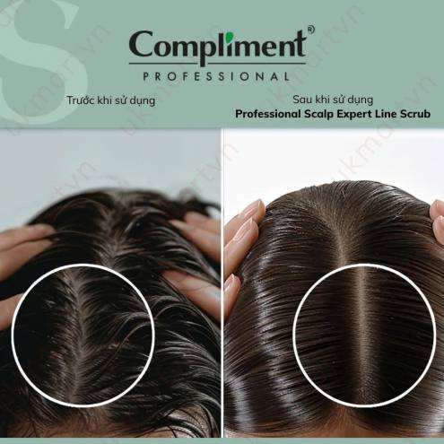 Tẩy Tế Bào Chết Da Đầu, Kiểm Soát Dầu & Ngừa Gàu Compliment Professional Scalp Expert Line Scrub 300ml