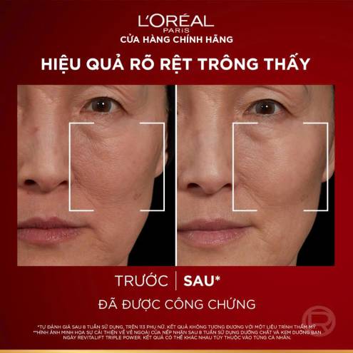 Serum Chống Lão Hóa LOreal Paris Revitalift Triple Power Age-Correcting 30ml
