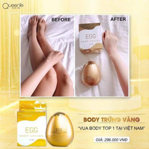 Kem Body Trứng Vàng Queenie Skin - Body Lotion EGG Tặng Kèm Huyết Thanh Kích Trắng