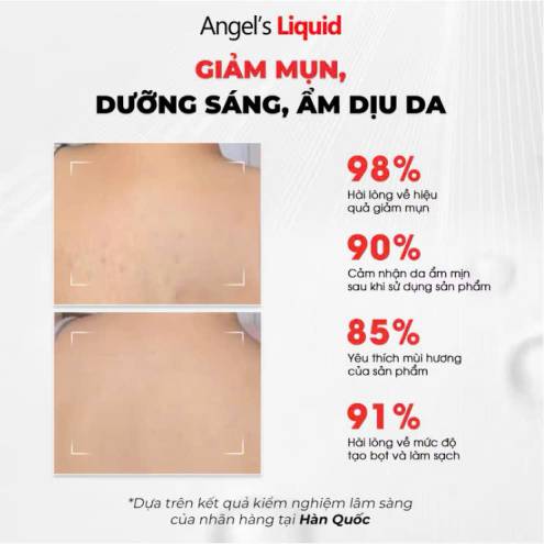 Sữa tắm giảm mụn mờ thâm Angel's Liquid Glutathione BHA Exfoliating Body Wash 500g