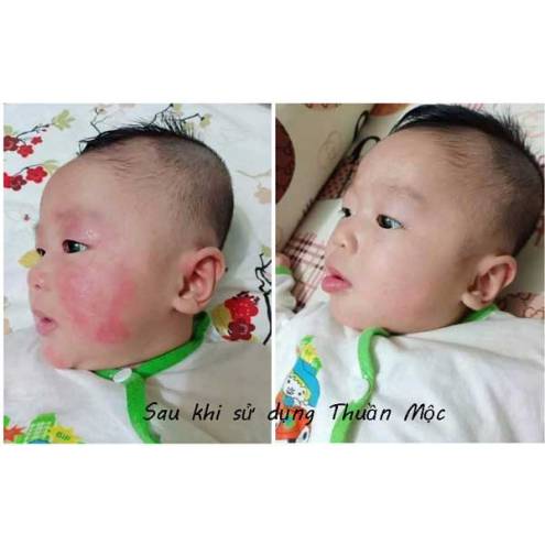 Kem bôi da Thuần Mộc Thanh Mộc Hương