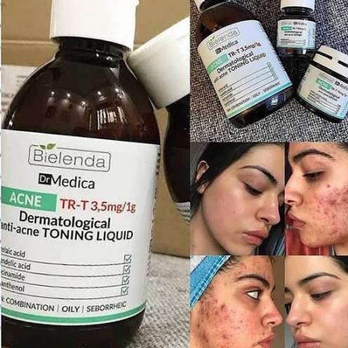 Nước Hoa Hồng Ngừa Mụn Toner Bielenda Dr Medica Dermatological Anti-acne Toning Liquid  